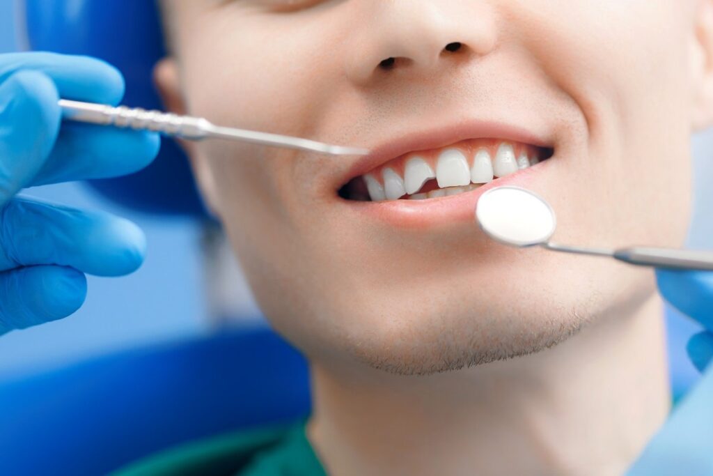 broken or knocked out tooth in mount royal calgary