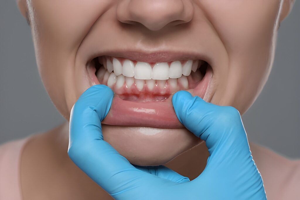 gum disease treatment near you