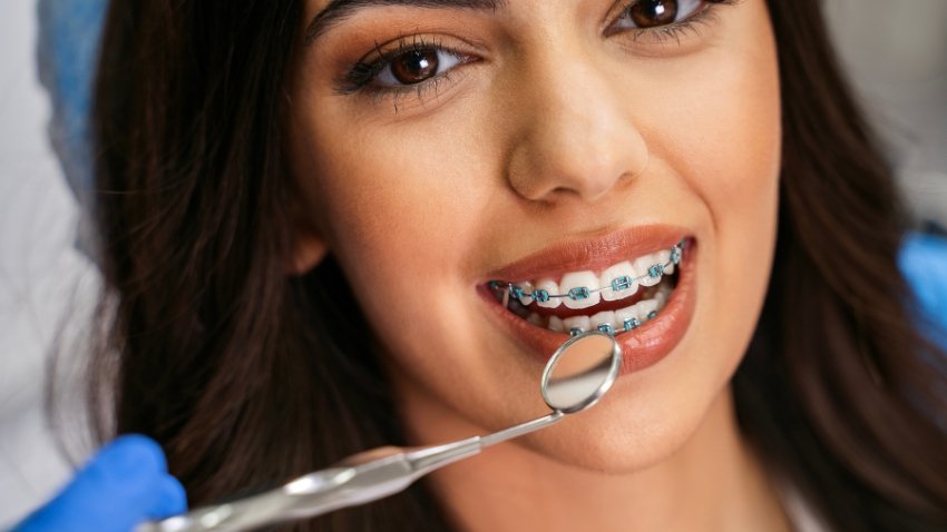 orthodontic maintenance near you